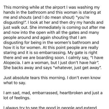 LADY RECOUNTS EMBARRASSMENT SHE FACES OVER ALOPECIA AT THE AIRPORT