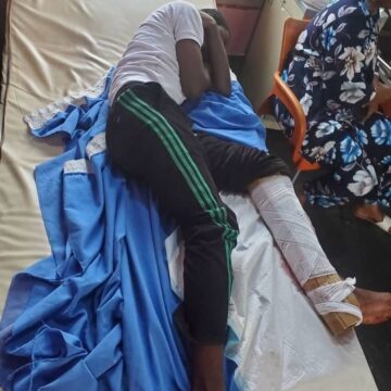 21-YEAR-OLD ALLEGEDLY SHOT AND LEFT IN A DITCH BY NIGERIA POLICE AFTER DEMANDING FOR 200K