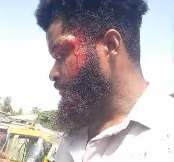 FORCE BRUTALITY UPDATE: MAN DEMANDS FOR IMMEDIATE TERMINATION OF MAJOR GENERAL AND CORPORALS, N150 MILLION COMPENSATION.