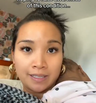 Mother Whose Baby Was Born With A Full Set Of Teeth, Hope To Raise Awareness Natal Teeth Condition