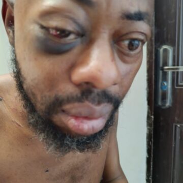 Video: “I Was Kidnapped By Seyi Tinubu After I Rejected 100 Million Naira Bribe” —National Association Of Nigerian Students President Cries Out.