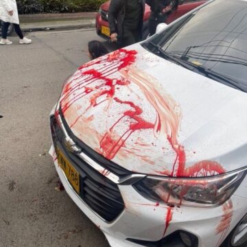 15-Year-Old Teenager Shoots Colombian Presidential Candidate Miguel Uribe, In The Head At An Event In Bogota.