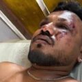 The Only Survivor Of Air India Flight 171, London-Bound Boeing 787, Says “I Don’t Know How I Survived.”
