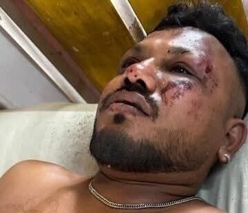 WhatsApp Image 2025-06-13 at 08.47.57_84d9db23 The Only Survivor Of Air India Flight 171, London-Bound Boeing 787, Says “I Don’t Know How I Survived.”