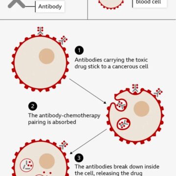 WhatsApp Image 2025-06-13 at 12.18.04_3a9bc185 World-First Blood Cancer Therapy To Be Given On NHS