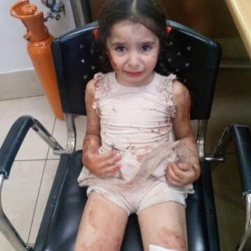 Photo: Child Survivor Of The Attack At The St. Elias Church In Damascus, Family Status Yet Unknown