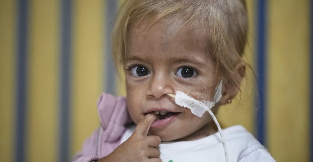 WhatsApp Image 2025-09-06 at 09.21.36_9691d7d8 Toddler Evacuated From Gaza With Rare Disease Recovers From Malnutrition In Italian Hospital