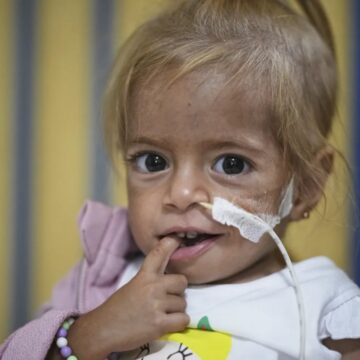 WhatsApp Image 2025-09-06 at 09.21.36_9691d7d8 Toddler Evacuated From Gaza With Rare Disease Recovers From Malnutrition In Italian Hospital
