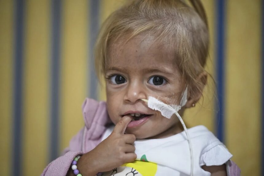Toddler Evacuated From Gaza With Rare Disease Recovers From Malnutrition In Italian Hospital