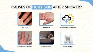 How To Prevent After Bath Itching