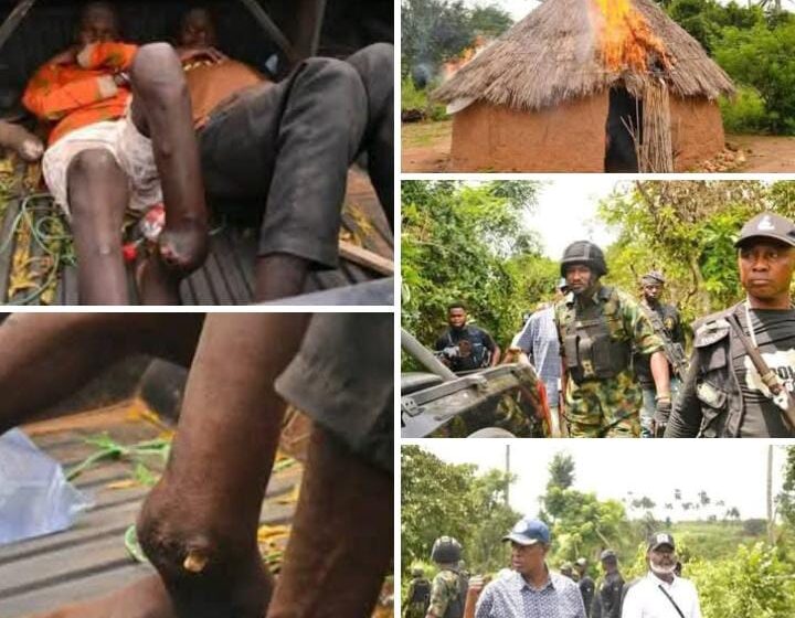 WhatsApp Image 2025-10-18 at 10.28.50_7afe6e33 Security operatives in Kogi State have arrested two fleeing bandits with bullet wounds, along with two medical personnel treating them, after raiding their camp in Kabba Bunu Local Government Area.