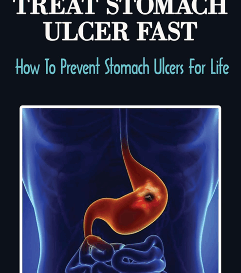 Understanding Ulcers: Causes, Symptoms And Care. 