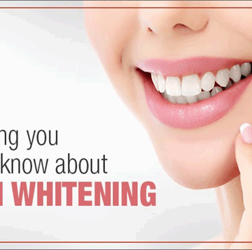 The Truth About Teeth Whitening: Safe Or Risky?