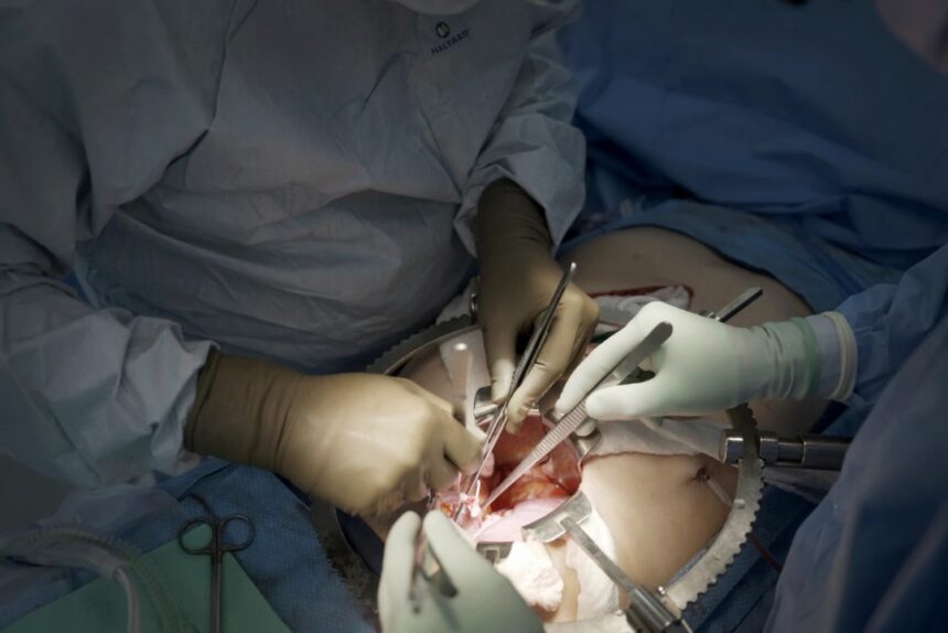 WhatsApp Image 2025-11-04 at 08.40.29_2c2a3aa8 First Clinical Trial Of Pig Kidney Transplants Gets Underway
