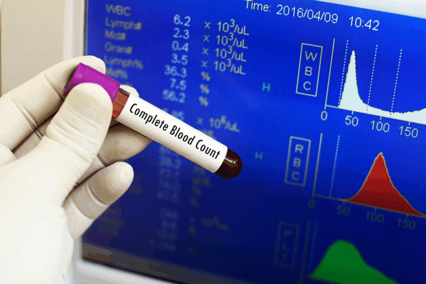 image Blood Count Tests: What They Reveal About Your Health