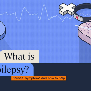  Epilepsy: Causes, Symptoms & Living Well