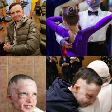 11-Year-Old Ukrainian Roman Oleksiv, Describes Surviving Russia’s July 14, 2022 Strike On Vinnytsia, At The European Parliament