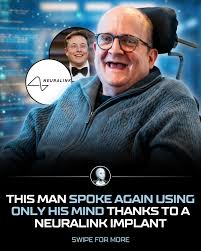 image “Neuralink Enables People With ALS To Speak Again”— Majority Owner Of The Brain-Computer Interfaces, Elon Musk Points Out